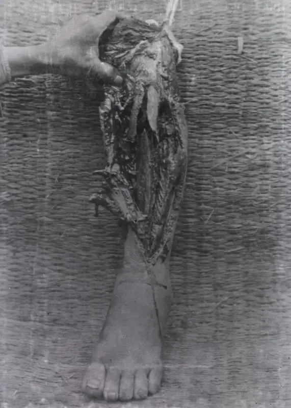 expanded image